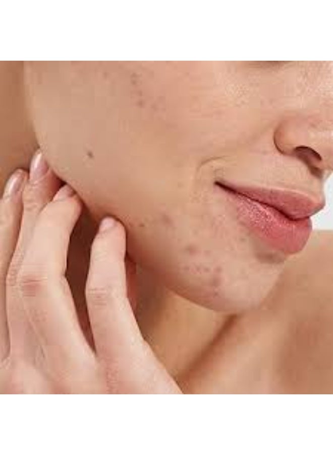 Pai Salicylic Acid 10ml - Image 3