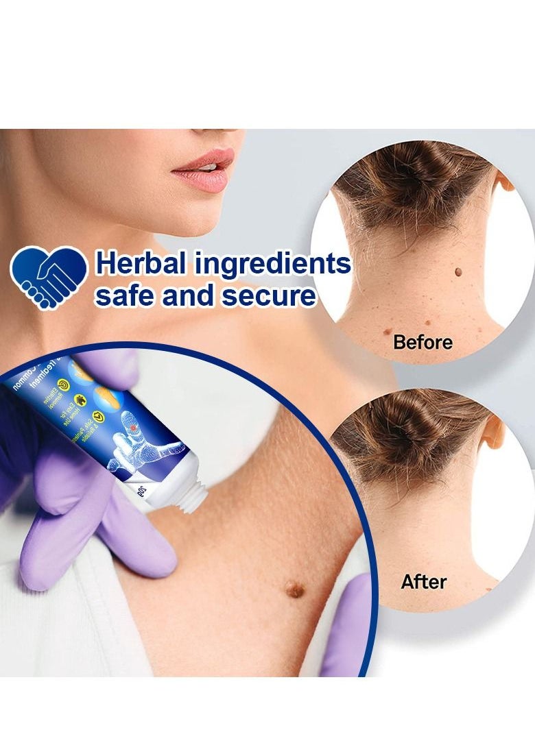 Sumifun - Wart Remover Ointment Natural Herbal Ingredients - Image 1