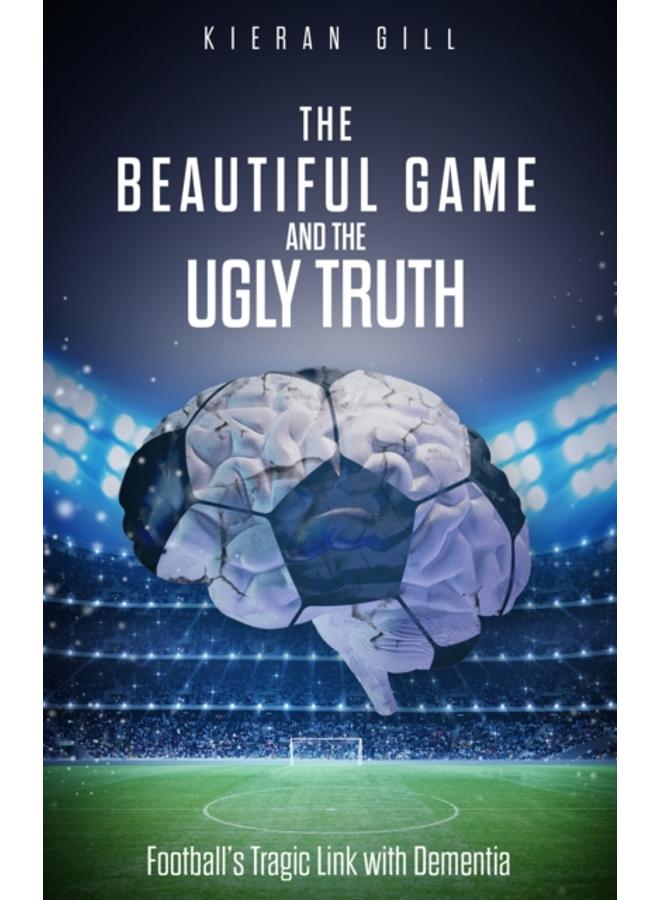 The Beautiful Game and the Ugly Truth : Football's Tragic Link with Dementia 