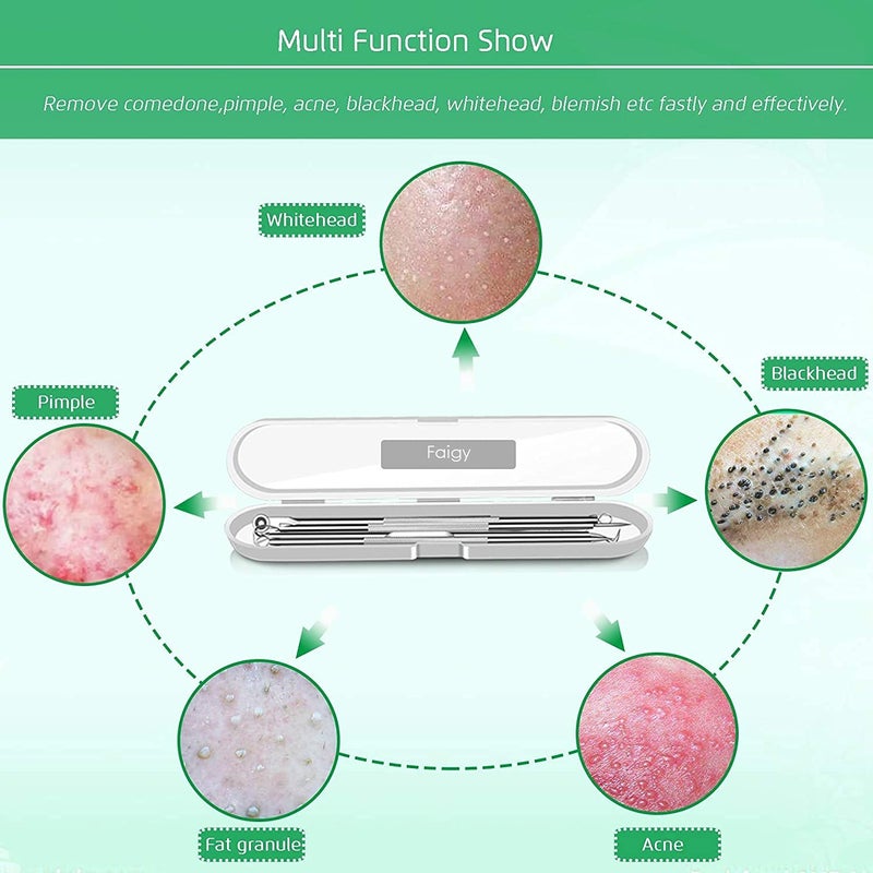 Faigy 4PCS Blackhead Remover Comedone Extractor, Curved Blackhead Tweezers Kit, Professional Stainless Pimple Acne Blemish Removal Tools Kit - Image 5