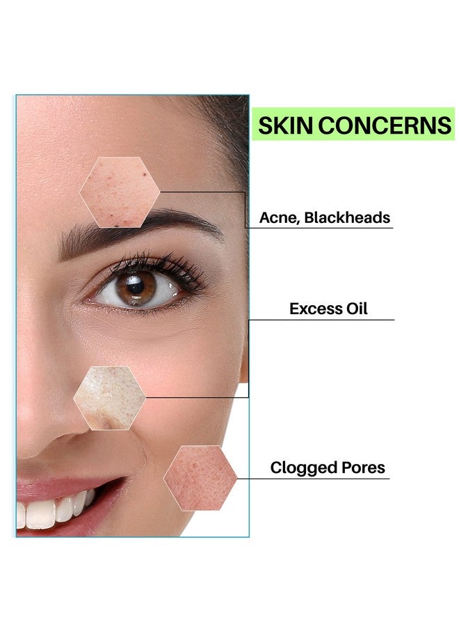 DermDoc Face Wash For Oily & Acne Prone Skin 120 Ml | Helps Reduce Acne, Blackheads, Regularizes Sebum Production, Evens Skin Texture | No Parabens, Silicones, Sulphates,Mineral Oil - Image 3