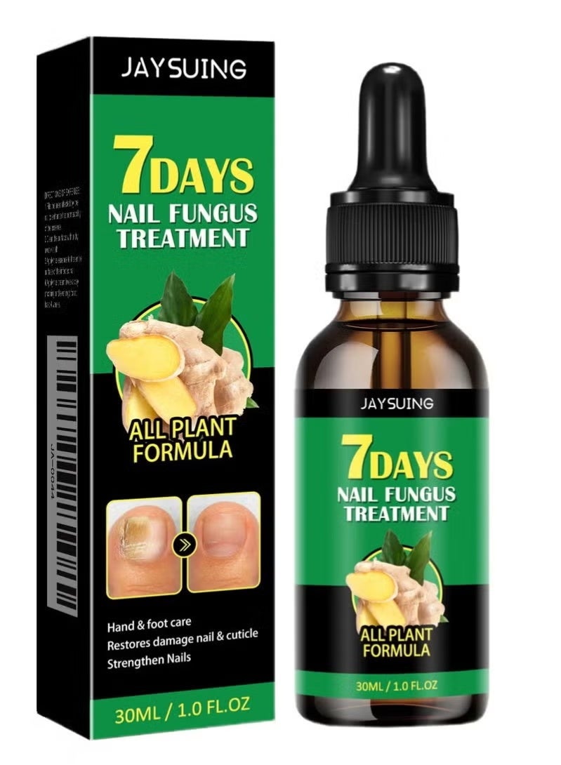 7 Days Ginger Foot Spray Nail Repair Ginger Nail Treatment Ginger Nail Treatment Ginger Cuticle Care Oil For Nails Strengthener Oil 30Ml 1Pc