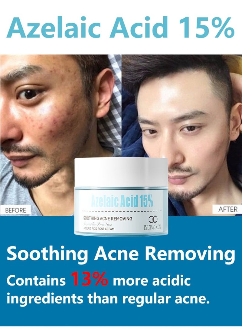 LYDIMOON 15% Azelaic Acid Acne Cream - Image 2