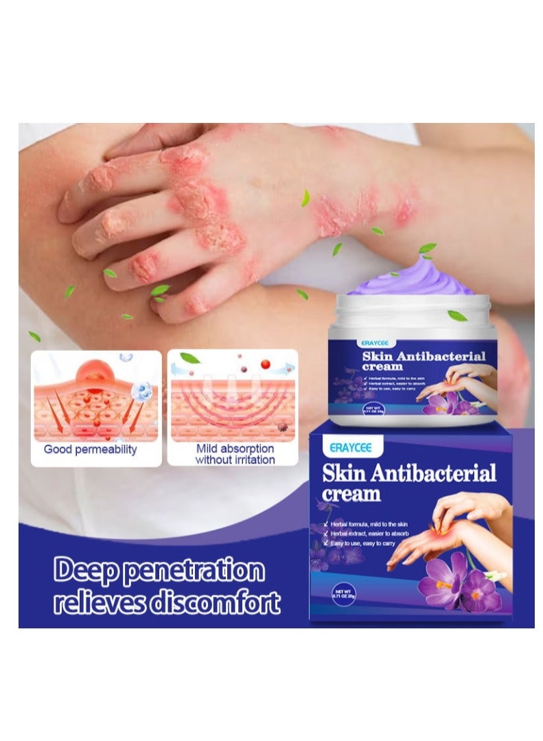 ERAYCEE Skin Antibacterial Anti Itch Cream, Bug Bite Itch Relief, Soothes Sunburns, Rashes, and Minor Skin Irritation - Image 2