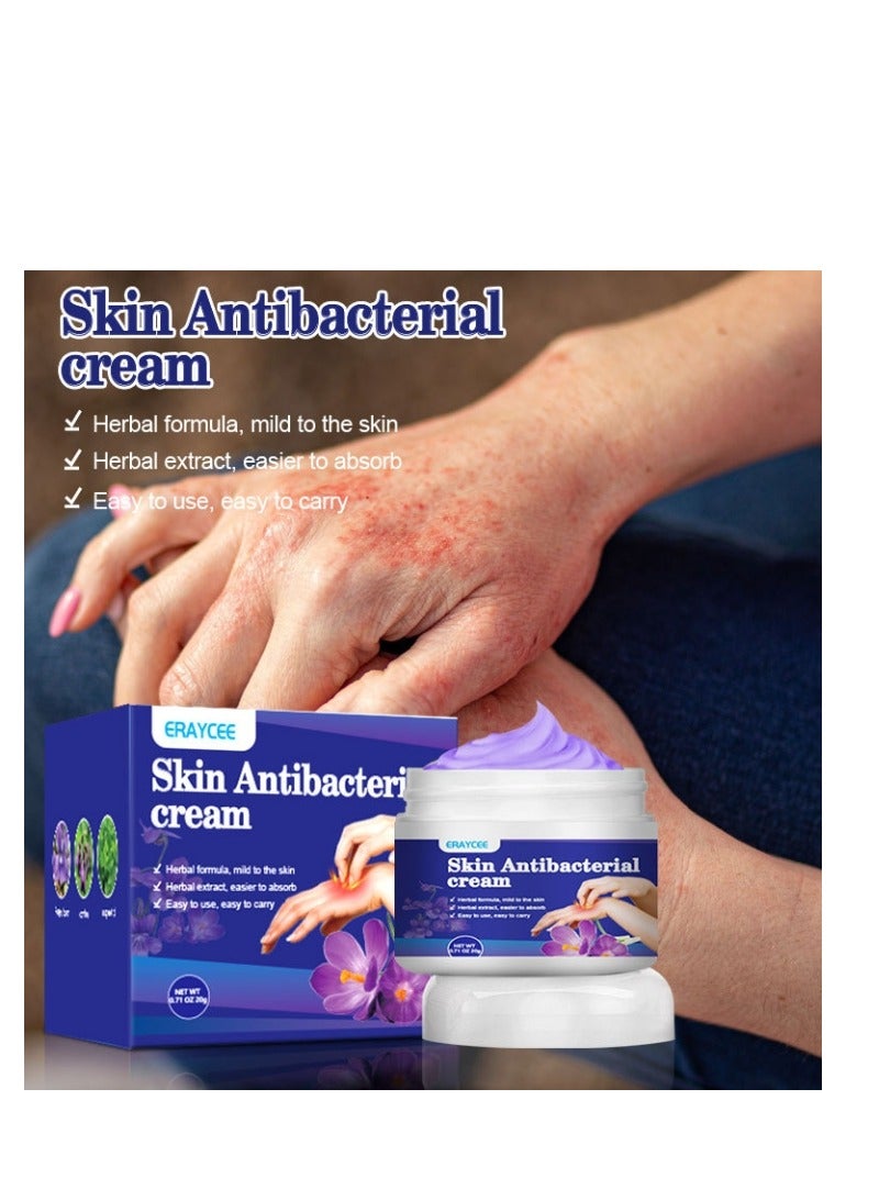 ERAYCEE Skin Antibacterial Anti Itch Cream, Bug Bite Itch Relief, Soothes Sunburns, Rashes, and Minor Skin Irritation - Image 3