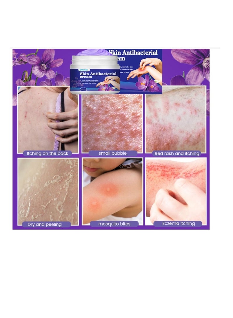 ERAYCEE Skin Antibacterial Anti Itch Cream, Bug Bite Itch Relief, Soothes Sunburns, Rashes, and Minor Skin Irritation - Image 5