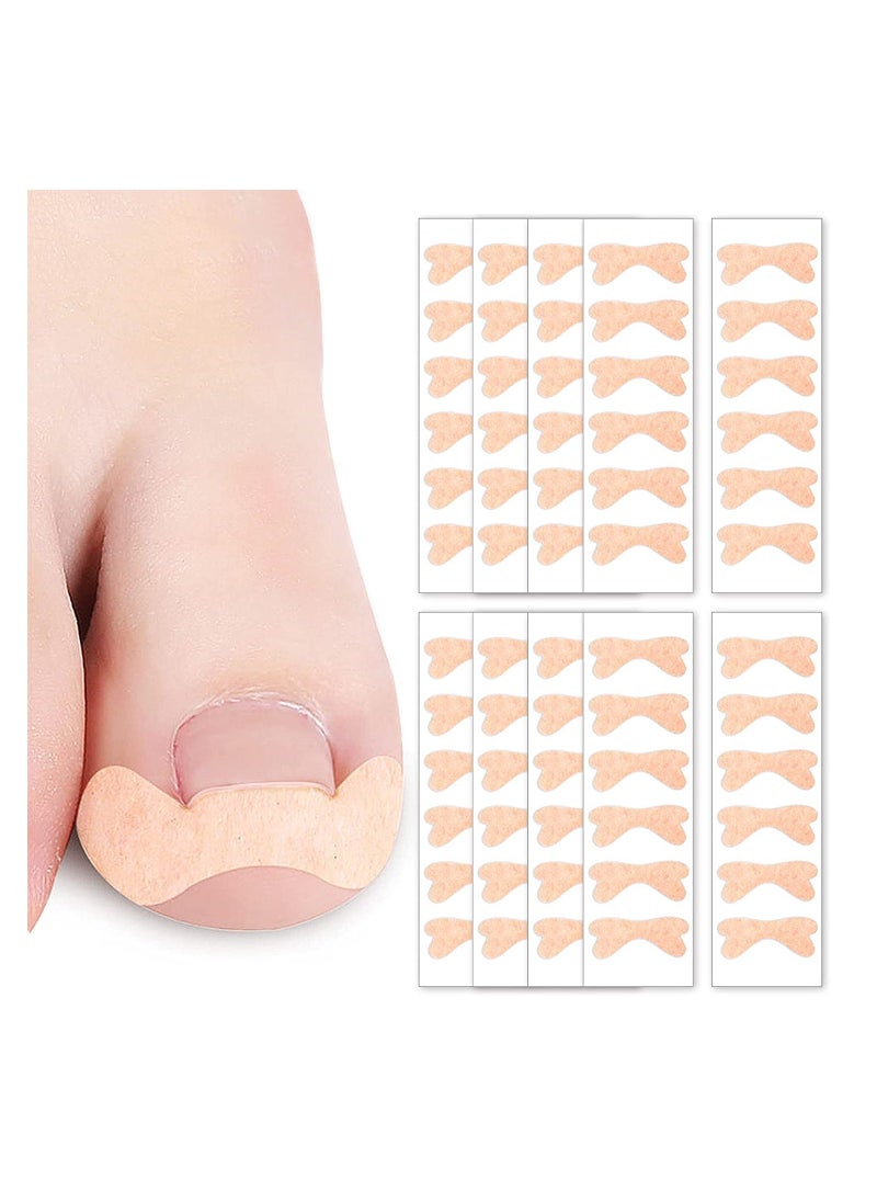 Generic - Ingrown Toenail Correction Sticker, Adhesive Toenail Patch, Elastic Nail Treatment Corrector Sticker, Professional Foot Care Tools, for Men Keep Nails Healthy (120 Pieces ) - Image 1