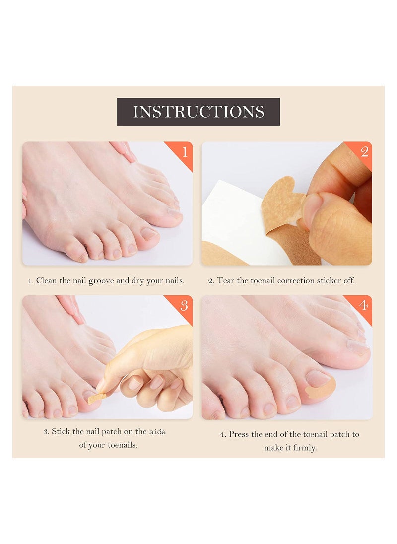Generic - Ingrown Toenail Correction Sticker, Adhesive Toenail Patch, Elastic Nail Treatment Corrector Sticker, Professional Foot Care Tools, for Men Keep Nails Healthy (120 Pieces ) - Image 1