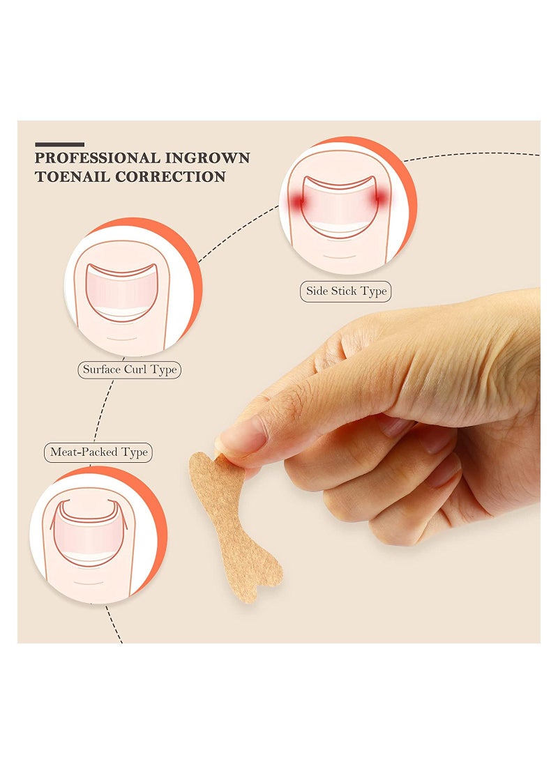 Generic - Ingrown Toenail Correction Sticker, Adhesive Toenail Patch, Elastic Nail Treatment Corrector Sticker, Professional Foot Care Tools, for Men Keep Nails Healthy (120 Pieces ) - Image 1