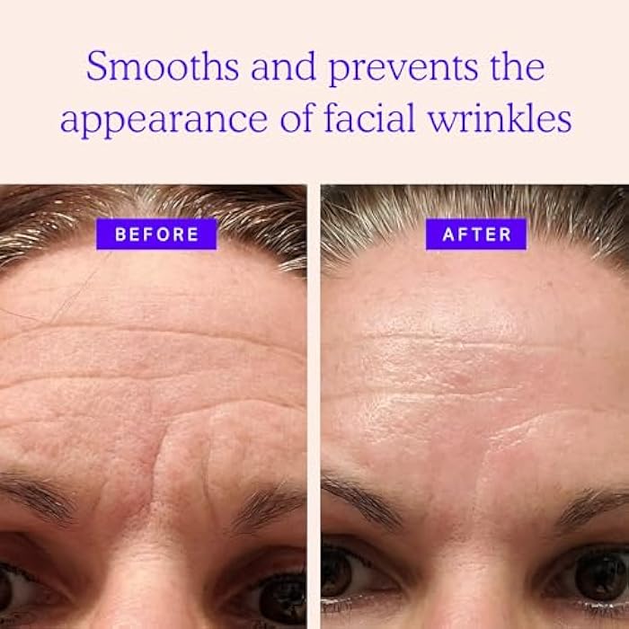 BLUMBODY Face, Forehead Wrinkle Patches – Mini Anti-Wrinkle Facial Patches for Eyes, Mouth, Forehead – Triangle Non-Silicone Face Tape for Elevens, Crows Feet and Fine Lines – 160 Facial Patches - Image 2