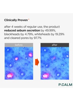 P.CALM P.CALM Underpore Facial Foaming Cleanser 250 ml | Vegan Deep Pore Cleansing Facial Wash for Sensitive Skin | Korean Skincare  - Image 3
