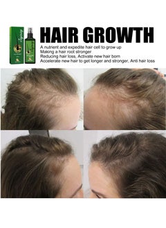 Jaysuing Hair Growth Serum Hair Lotion ,Hair Loss Treatments, Aids against Hair-thining, Hair Regrowth Treatment  - Image 2