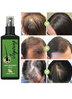 Jaysuing Hair Growth Serum Hair Lotion ,Hair Loss Treatments, Aids against Hair-thining, Hair Regrowth Treatment  - Image 5