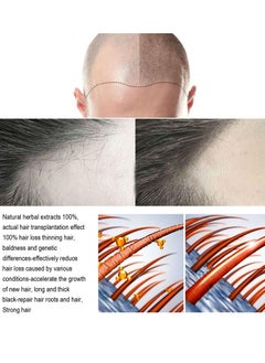 Jaysuing Hair Growth Serum Hair Lotion ,Hair Loss Treatments, Aids against Hair-thining, Hair Regrowth Treatment  - Image 4