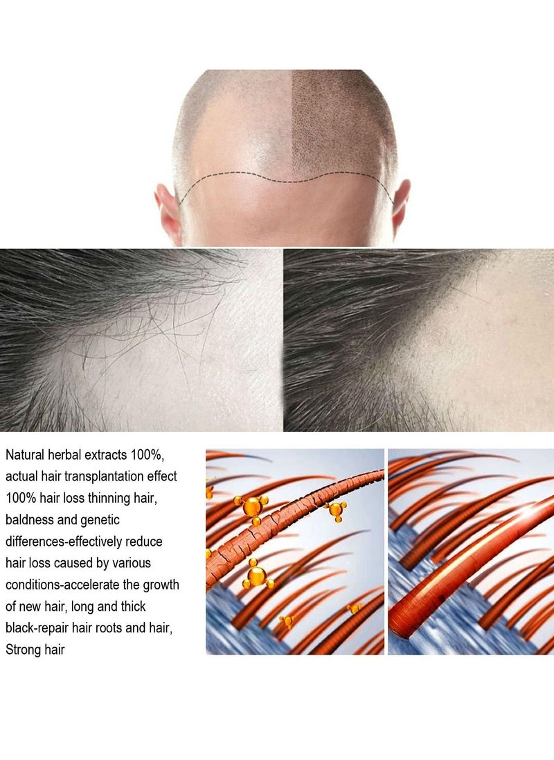 Jaysuing - Hair Growth Serum Hair Lotion ,Hair Loss Treatments, Aids against Hair-thining, Hair Regrowth Treatment - Image 1