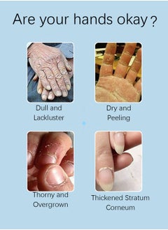 ZHENXIU Bovine Colostrum Silky Smooth Moisturizing Hand Mask, Brightening Exfoliating Hydrating Gloves for Dry Cracked Hands, Repairing Hand Moisturizer 40g 1 Pair  - Image 3