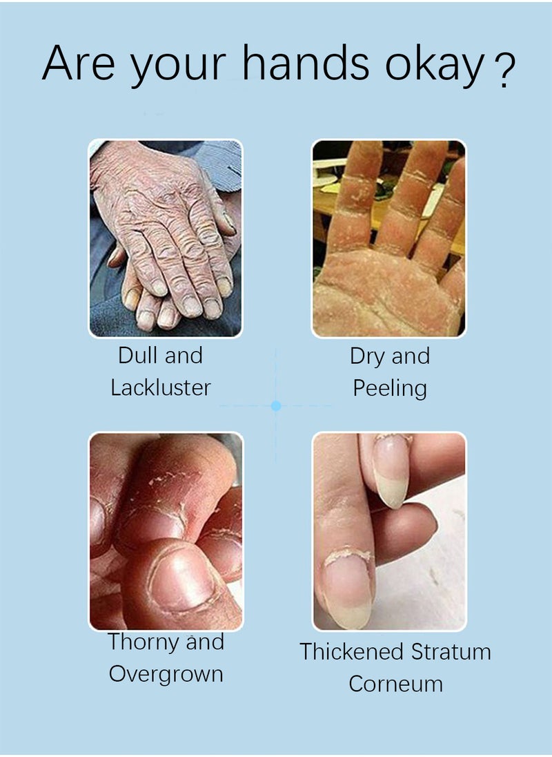 ZHENXIU Bovine Colostrum Silky Smooth Moisturizing Hand Mask, Brightening Exfoliating Hydrating Gloves for Dry Cracked Hands, Repairing Hand Moisturizer 40g 1 Pair  - Image 3
