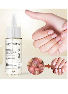 JoyPretty Nail Repair Essence Oil, Intense Nail Growth And Strength Serum, Moisturizing Nail Fungal Treatment Hand Foot Care Essence, Toenail Anti Onychomycosis Infection Removal Paronychia Liquid  - Image 5