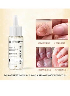 JoyPretty Nail Repair Essence Oil, Intense Nail Growth And Strength Serum, Moisturizing Nail Fungal Treatment Hand Foot Care Essence, Toenail Anti Onychomycosis Infection Removal Paronychia Liquid  - Image 4