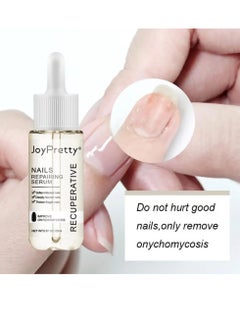 JoyPretty Nail Repair Essence Oil, Intense Nail Growth And Strength Serum, Moisturizing Nail Fungal Treatment Hand Foot Care Essence, Toenail Anti Onychomycosis Infection Removal Paronychia Liquid  - Image 2