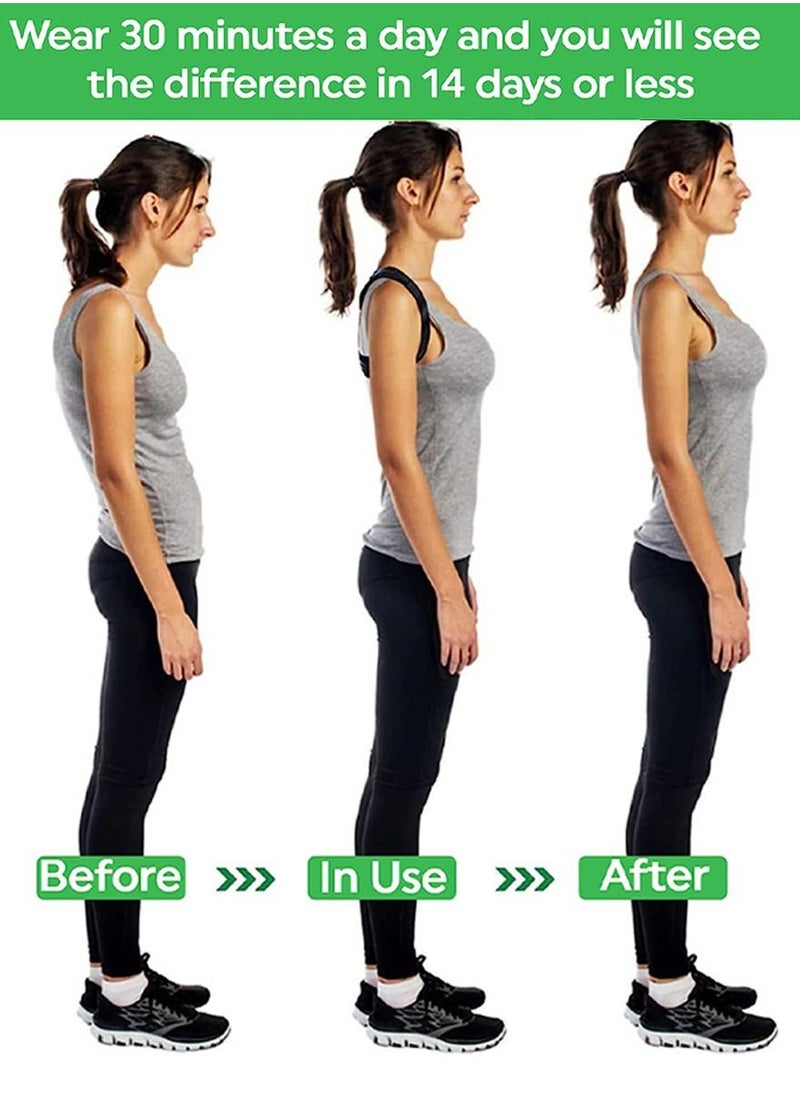 QUTOOB - Posture Corrector for Back and Shoulders, Relieves Pain In The Upper Back, Neck And Shoulders, Suitable For Women and Men, Posture Trainer for Spinal Alignment Can Help With Hunchback Hump Correction - Image 1