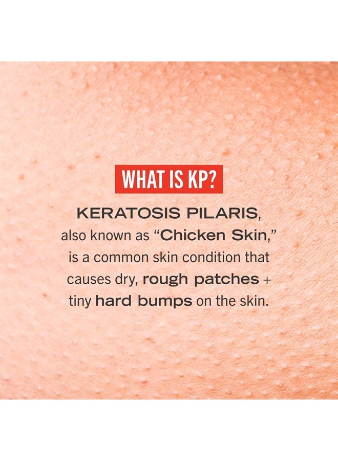 First Aid Beauty KP Bump Eraser Body Scrub Exfoliant for Keratosis Pilaris with 10% AHA 4 oz.