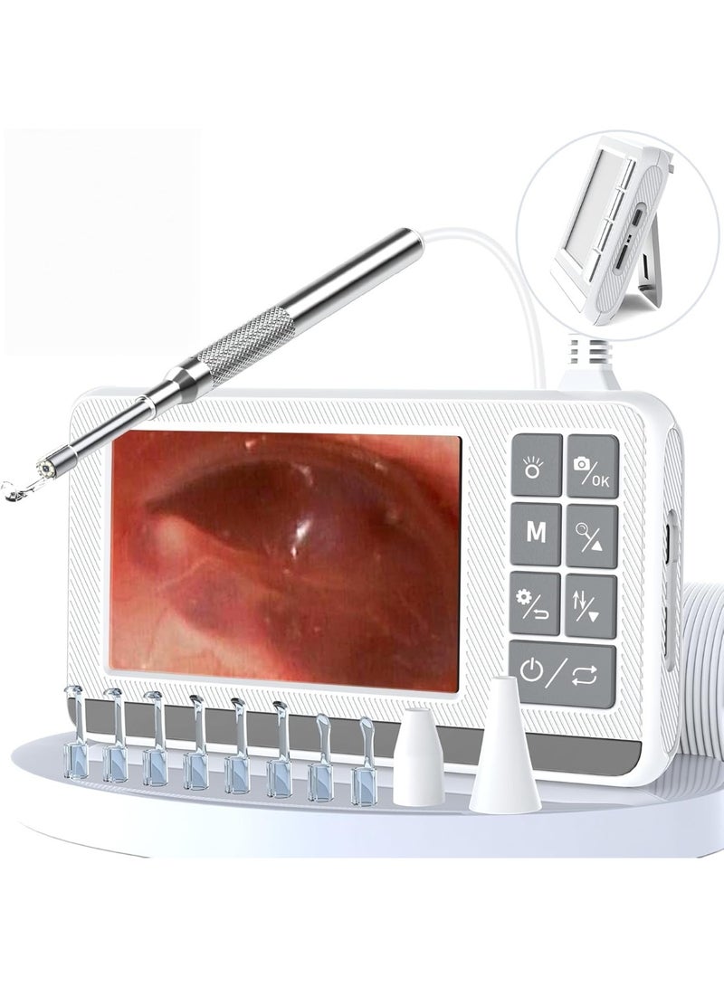 مزيل شمع الأذن بشاشة، كاميرا متعددة الوظائف مع منظار أذن مضاء، منظار أذن 3.9 مم، مزود بشاشة IPS عالية الدقة 1920P مقاس 4.3 بوصة، أداة تنظيف شمع الأذن مقاومة للماء بمعيار IP67، التوصيل والتشغيل، مناسب للبالغين والأطفال والحيوانات الأليفة (أبيض). - Image 1