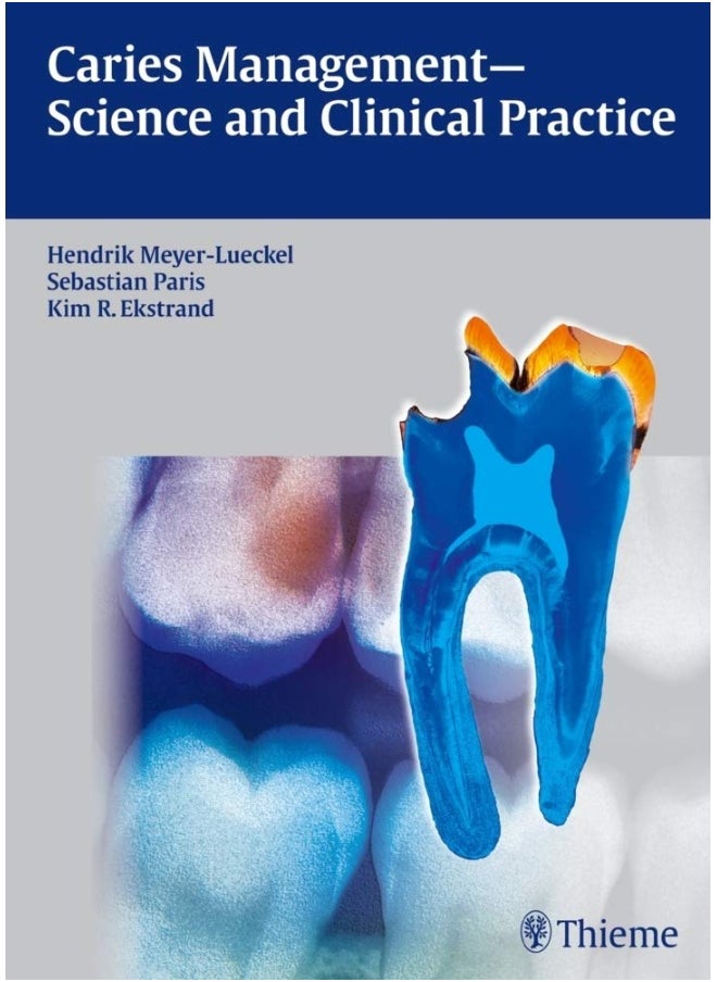 Caries Management - Science and Clinical Practice  - Image 3