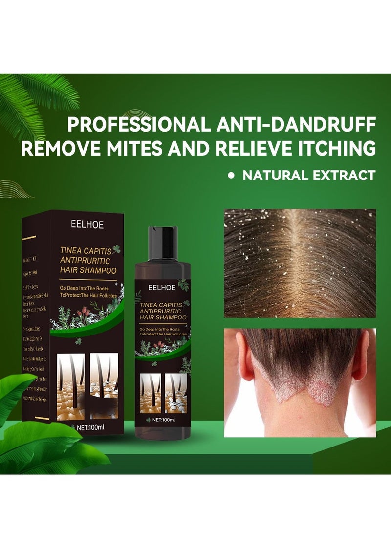 EELHOE شامبو مضاد للحكة لفروة الرأس، شامبو مضاد للقشرة، شامبو لفروة الرأس المعرضة لالتهاب الجريبات الشعرية، التهاب الجلد، القشرة، العث، فروة الرأس الحاكة والمتقشرة، يعالج القشرة والتهاب الجلد الدهني - Image 2