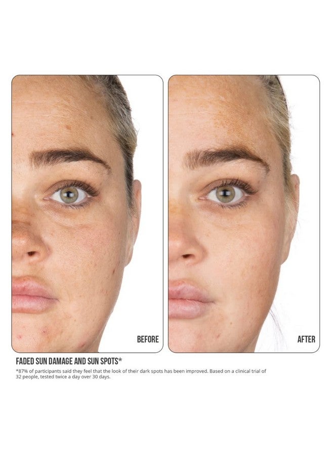 NIP+FAB تركيز فيتامين سي من Ip+Fab 15% 1 أونصة سائلة؛ معزز إشراقة البشرة؛ 3 أشكال من فيتامين سي؛ حمض الفيروليك؛ حماية البشرة؛ مرطب ومضاد للأكسدة - Image 5