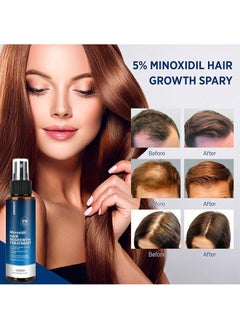 CARVENCHY Minoxidil Hair Regrowth Treatment, Hair Growth Serum 5% Spray for Stronger Thicker Longer Hair, Help to Stop Thinning and Loss Hair for Men and Women, 100ml  - Image 3