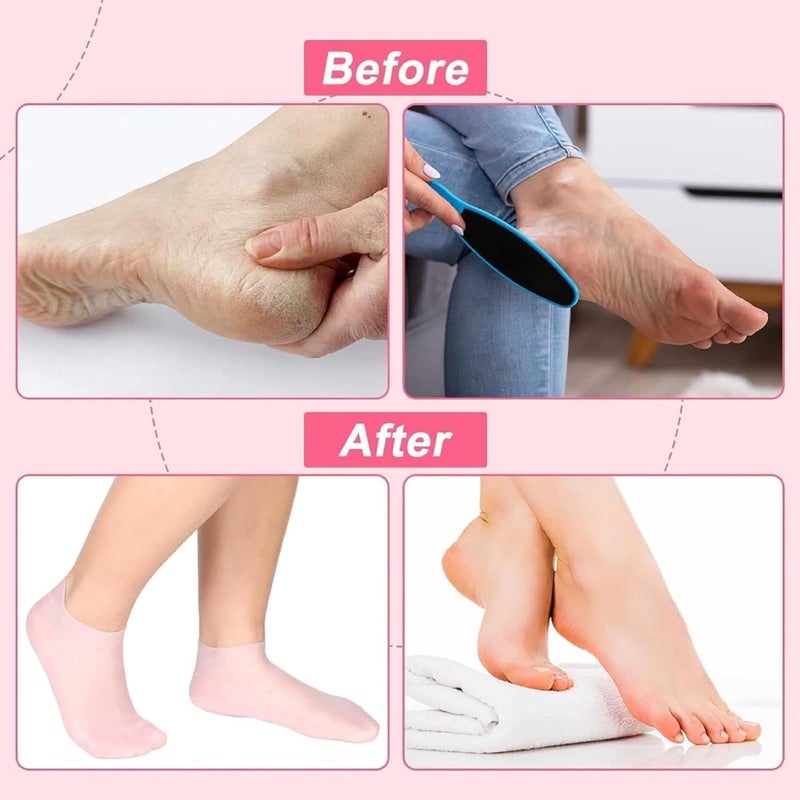 Generic Silicone Socks For Women Moisturizing Foot Socks Soft Gel Socks Aloe Socks Women Spa Pedicure Socks 2Pair Multicolor Silicon socks 2 count 104  - Image 2