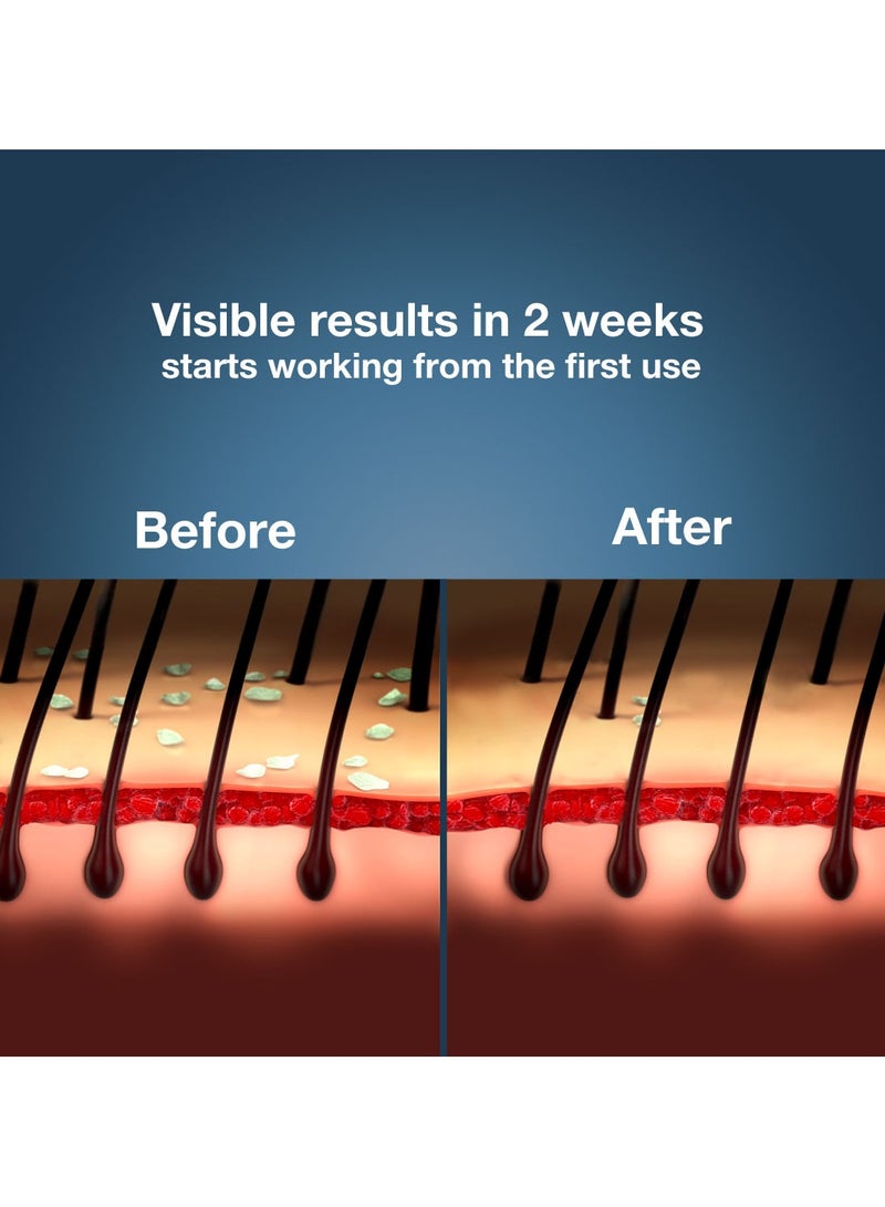 Nizoral Shampoo Against Dandruff And Seborrhoeic Dermatitis 100ml - Image 4