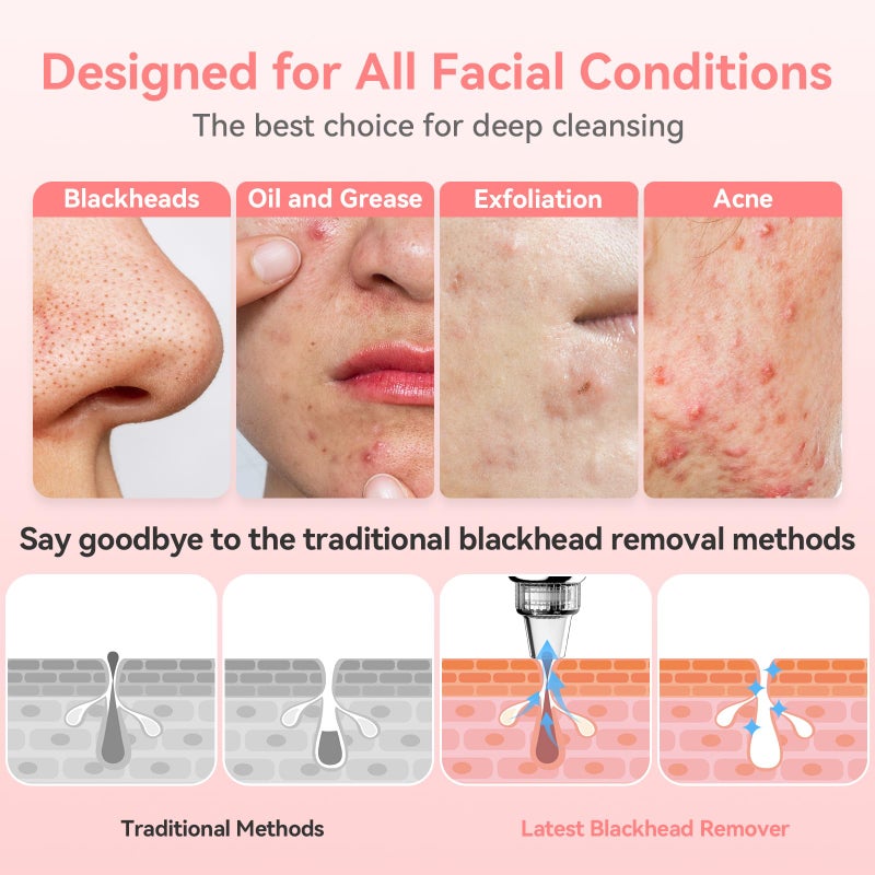 FREESHOW Blackhead Remover Pore Vacuum Upgraded Facial Pore Cleaner Electric Comedone Whitehead Extractor Tool-5 Suction Power,5 Probes,USB Rechargeable Blackhead Vacuum Kit for Women & Men - Image 4