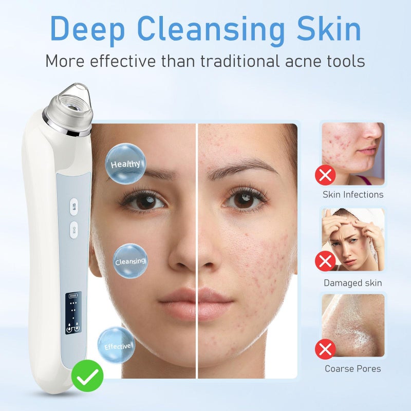 Ottleba Blackhead Remover Vacuum, USB Interface Type Pore Vacuum, Black Head Extractions Tool with Camera for Men and Women Pore Cleaner, 3 Adjustment Modes & 6 Suction Heads(White) - Image 4