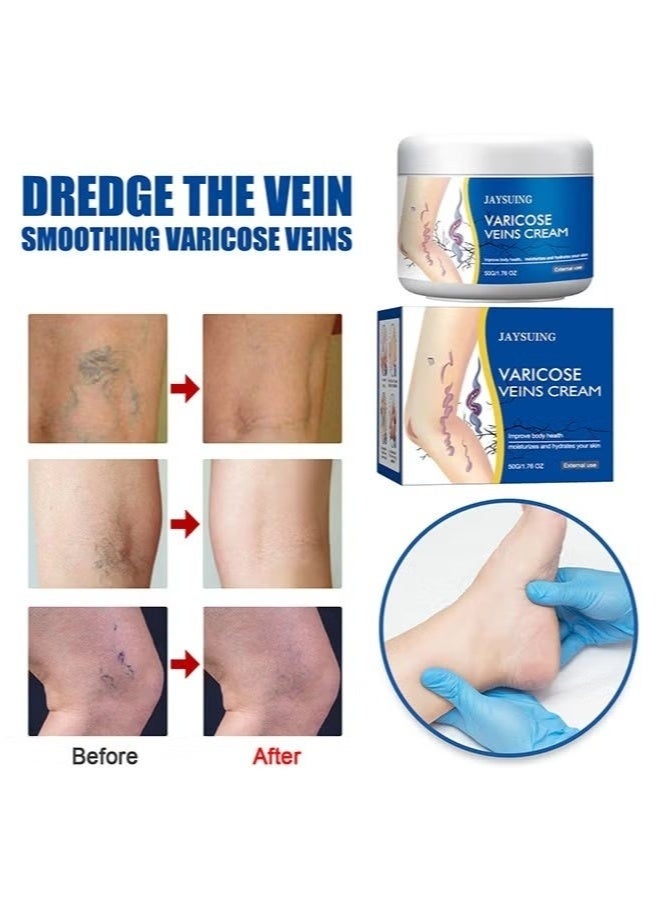 Jaysuing Varicose Veins Cream - Improves Blood Circulation, Reduces Spider Veins and Heaviness, 50G - Image 4