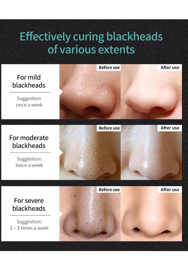LANBENA Blackhead Remover Pore Shrink Blackhead Peeling Deep Pore Cleansing Tool Skin Care Product  - Image 5
