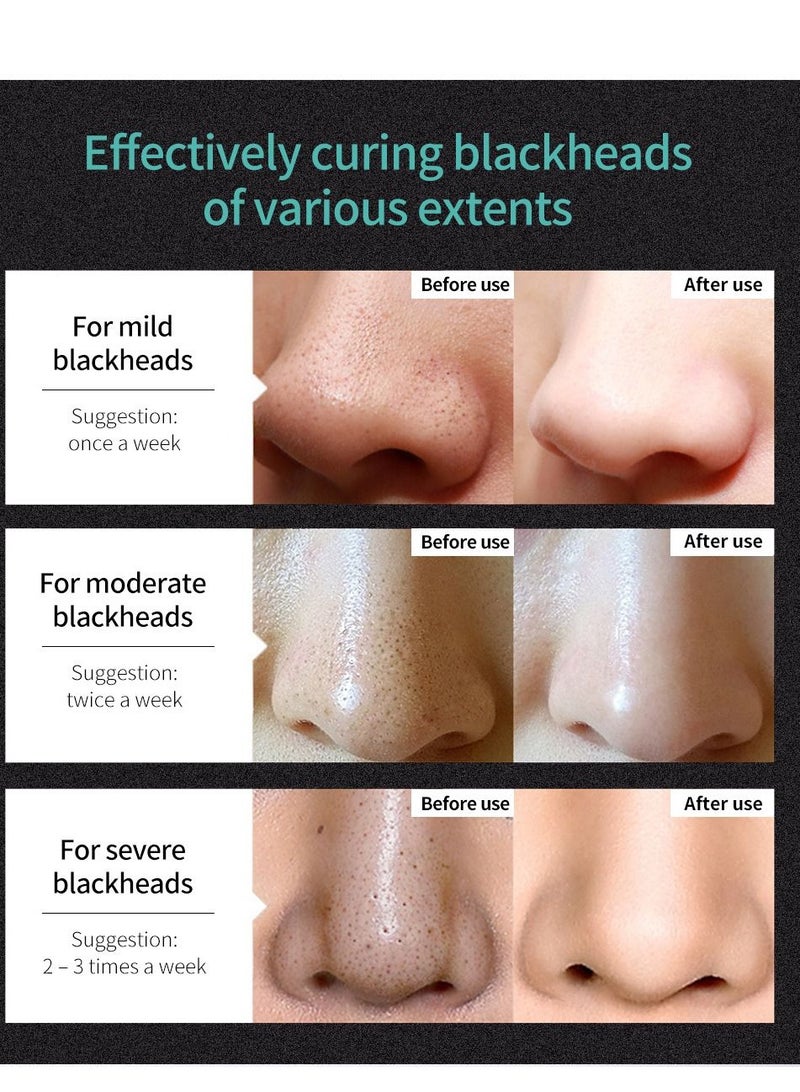لان بينا قناع إزالة الرؤوس السوداء، تنظيف عميق، يزيل الرؤوس السوداء، مناسب لجميع أنواع البشرة - Image 5