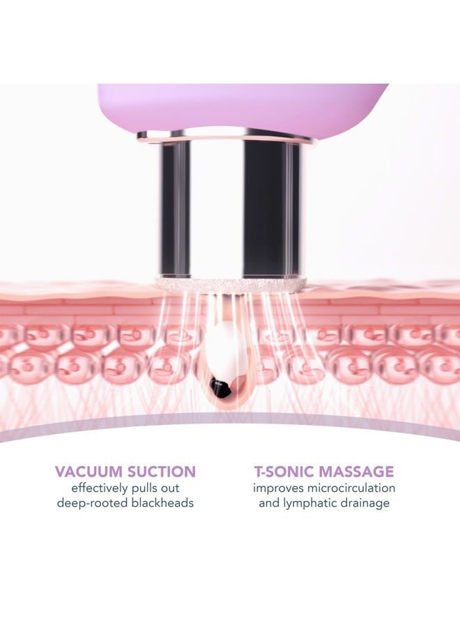 FOREO KIWI derma Microdermabrasion Machine Whitehead & Black Head Remover for Face - Skin Care Tools - Blackhead Extractor - No Pore Strips Suction - Vacuum Blackhead Remover - Image 3
