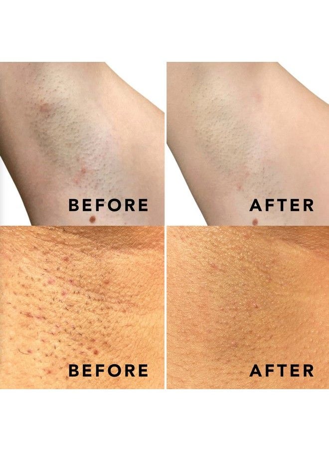 sweetspot labs Buff & Brighten Daily Ingrown Hair Treatment With Salicylic Acid And Niacinamide Safe For Bikini Area 50 Exfoliating & Brightening Pads  - Image 4