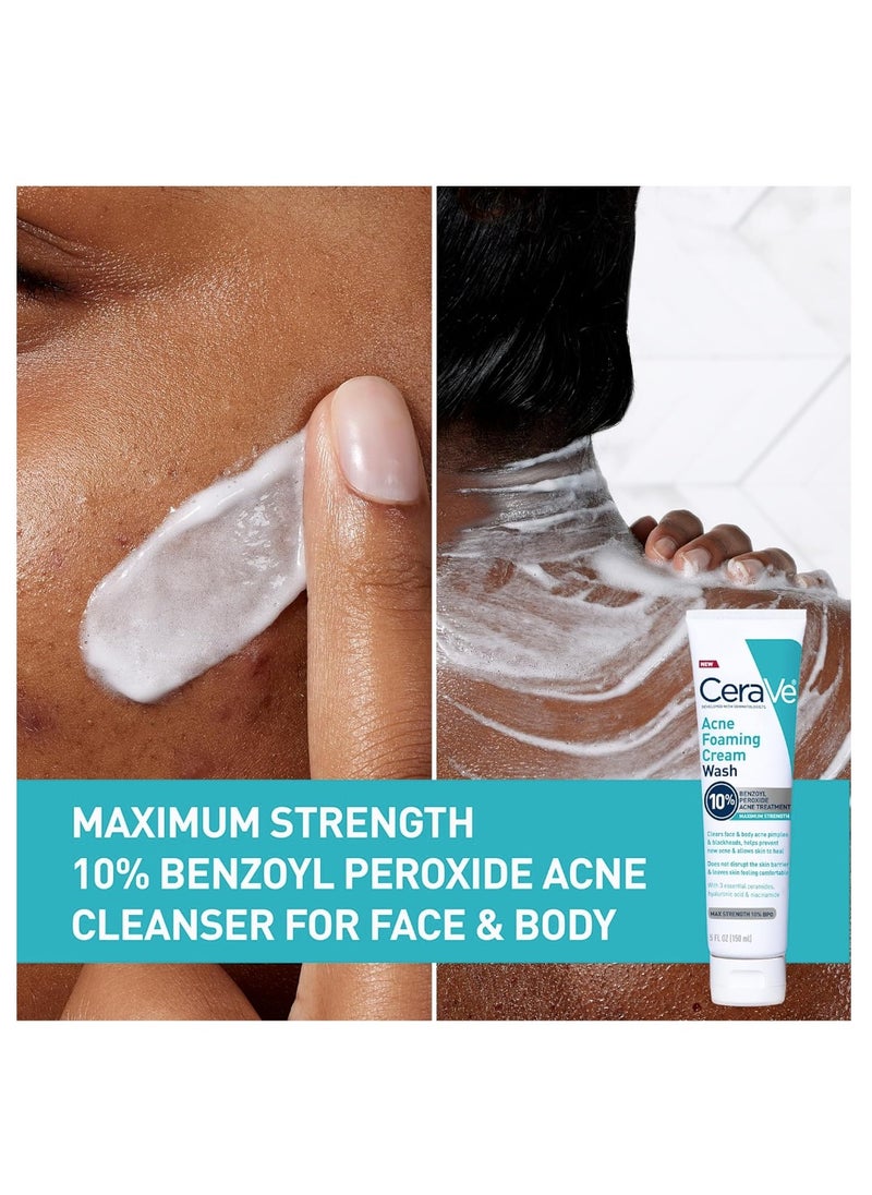 Acne Foaming Cream Wash 150ml