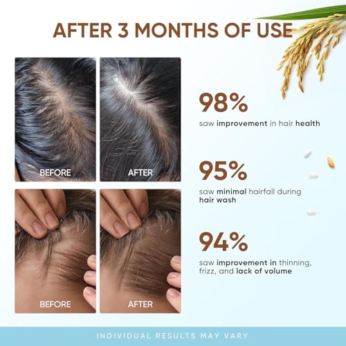 Svvimer Rice Water Hair Growth Shampoo - Biotin Thickening Shampoo for Hair Loss and Thinning - Sulfate Free for Women and Men 10 Fl Oz (Pack of 1) - Image 2