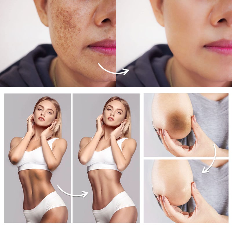 Famirosa فاميروزا مصحح البقع الداكنة في المناطق الحساسة: كريم تحت الإبط، للركب، المرفقين، الفخذين الداخليين، الأجزاء الخاصة - كريم للبشرة الحساسة 50 مل - Image 3