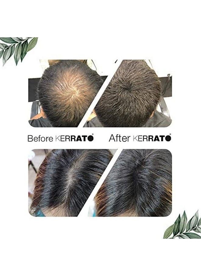 KERRATO HAIR FIBRES - للشعر الخفيف (أسود داكن) طبيعي 4G يخفي تساقط الشعر في 10 ثوانٍ، مكثف طبيعي للشعر وألياف للشعر الخفيف للرجال والنساء - Image 1