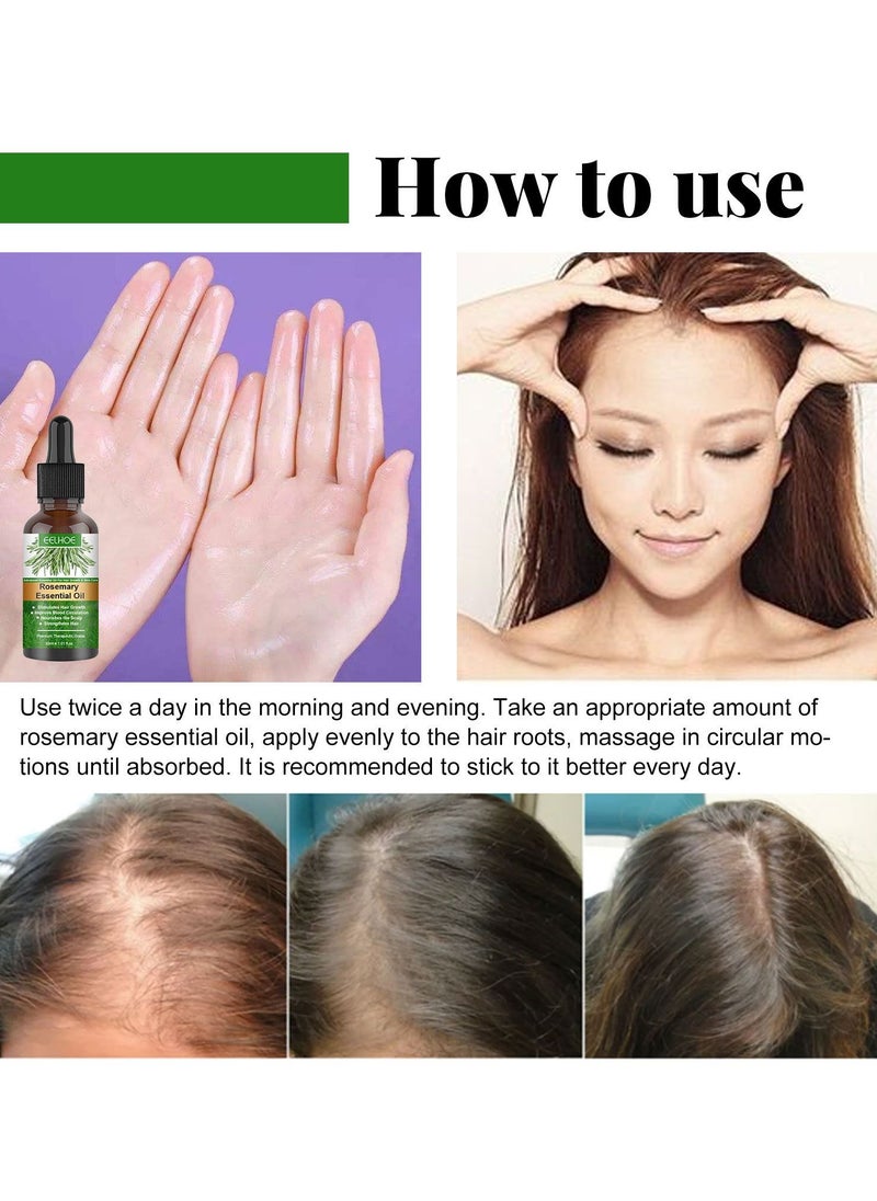 EELHOE - Rosemary Essential Oils, Pure Rosemary Oil for Hair Growth & Skin Care, Nourishment Scalp, Stimulates Growth - Image 1