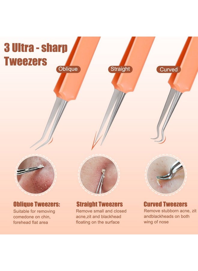 MORGLES - Blackhead Remover Tools Morgles 15Pcs Pimple Popper Tool Kit Professional Stainless Comedone Pimple Extractor Tool For Blackhead Blemish Zit Removing With Metal Case - Image 1