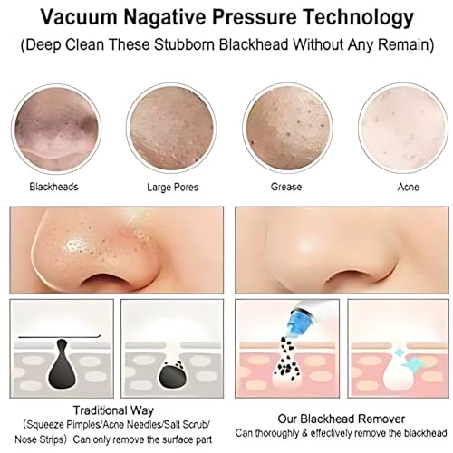 COALITION Multi Function Blackhead Whitehead Remover Vacuum Tool, Skin Cleaner, Pimple Removal Tool, Acne Pimple Pore Cleaner Vacuum Suction Extractor Device for Men and Women (4 In 1) - Image 3