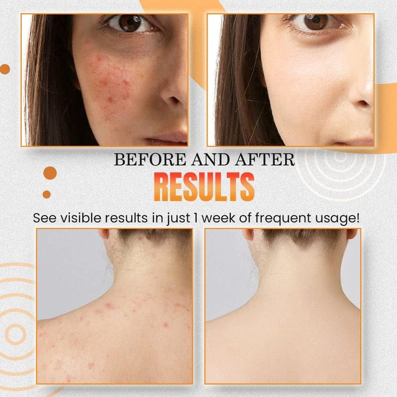 ويوبلز صابون الكركم من لانثوم، صابون الكركم والزنجبيل للبقع الداكنة، صابون زيت عطري طبيعي للوجه والجسم، صابون زنجبيل عضوي لتنشيط الجهاز اللمفاوي، صابون زنجبيل مرطب، صابون استحمام منظف للنساء والرجال - Image 5