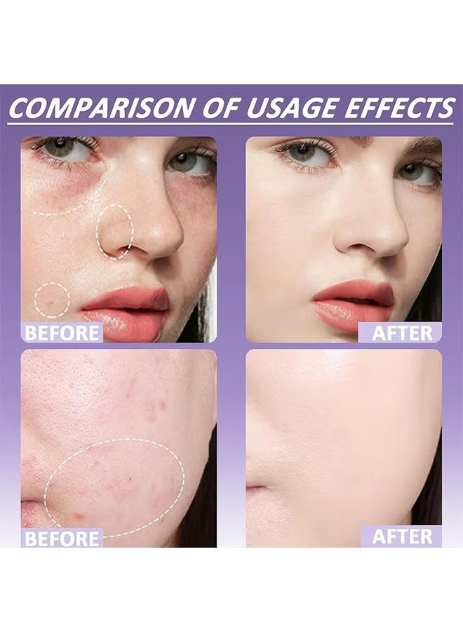 DETVFO Evanesce Soft Matte Cream Concealer, Waterproof Foundation, Full Coverage, Hydrating Long-Lasting Concealer, Moisturizing Contour And Brighten (01# Natural) - Image 4