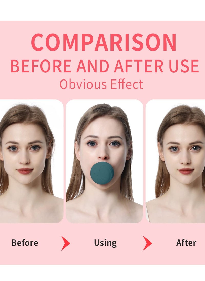 SYOSI Jawline Exerciser, Face Neck Jaw Toning Double Chin Reducer, Facial Blowing Exercisers Enhance Firming Lifting Jaw Facial V Shape Lines Define Your Jawline (2 Pack) (Green)  - Image 2
